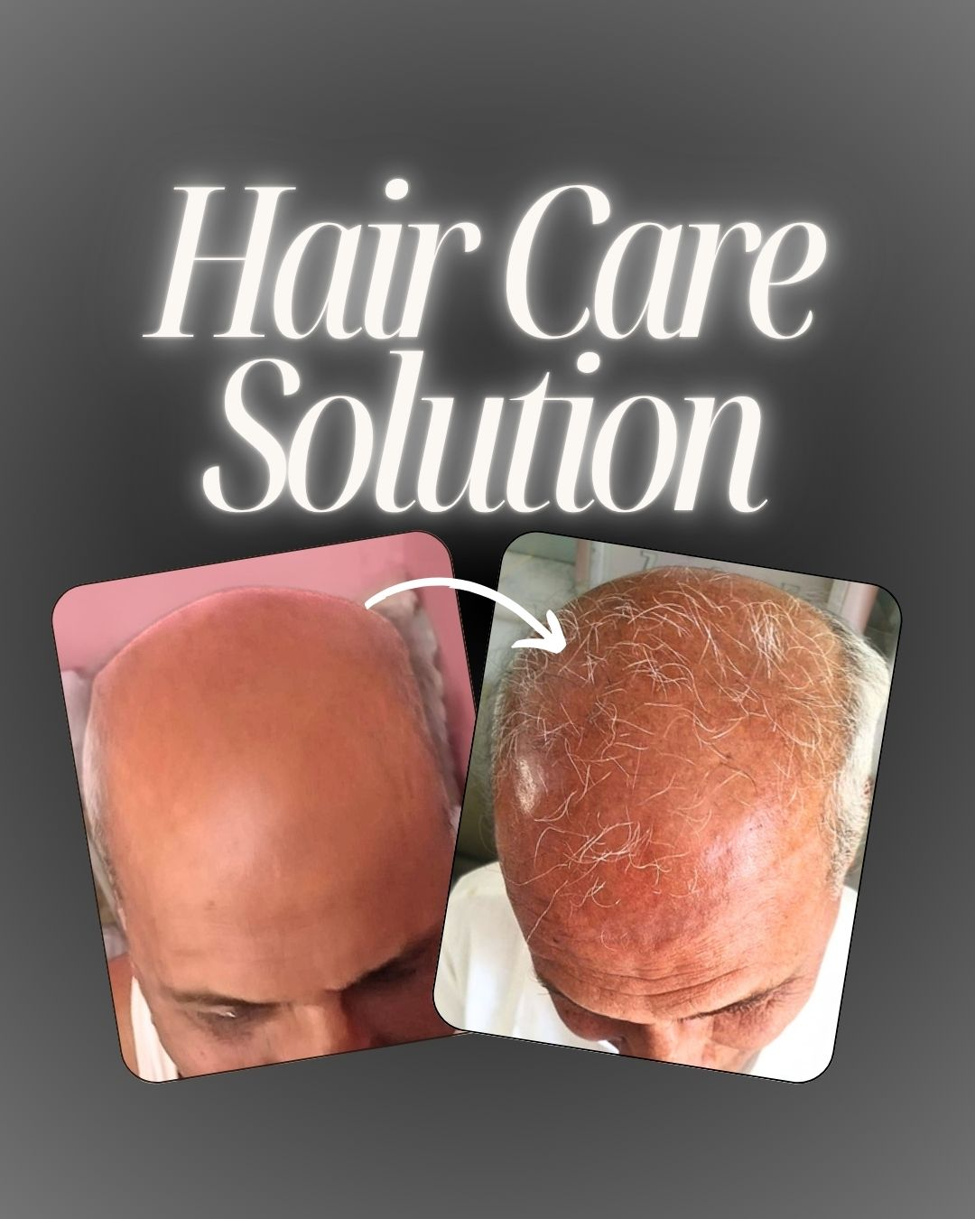Hair Care